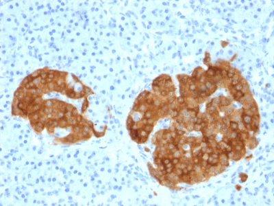 FFPE human pancreas sections stained with 100 ul anti-GAD2 (clone GAD2/1960) at 1:100. HIER epitope retrieval prior to staining was performed in 10mM Citrate, pH 6.0.